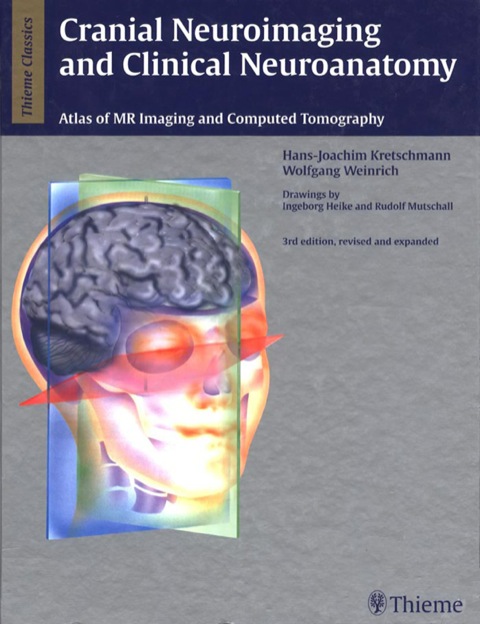 Cranial Neuroimaging and Clinical Neuroanatomy 