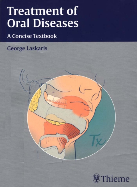 Cover image for book Treatment of Oral Diseases