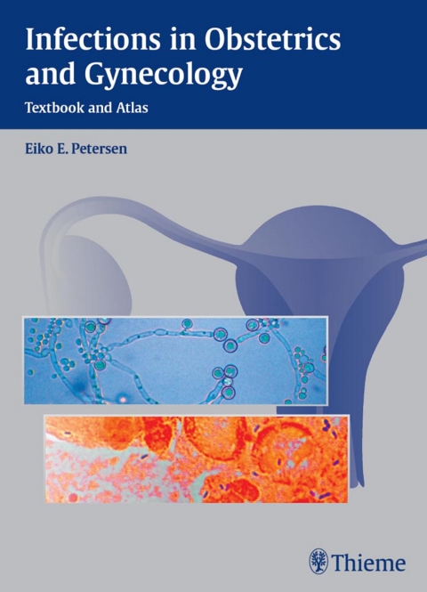 Cover image for book Infections in Obstetrics and Gynecology