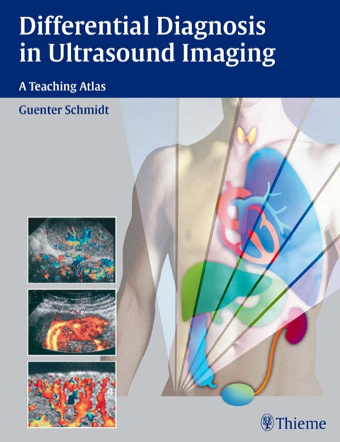 Cover image for book Differential Diagnosis in Ultrasound Imaging