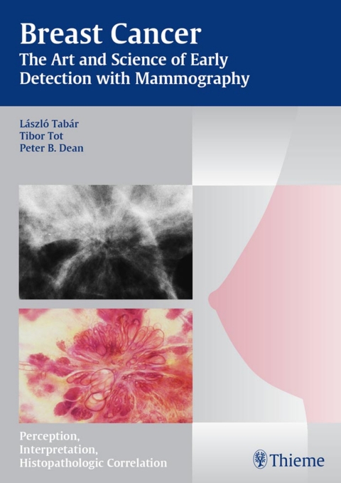 Cover image for book Breast Cancer - The Art and Science of Early Detection with Mammography