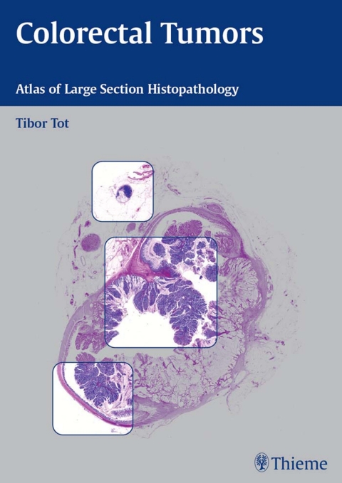 Cover image for book Colorectal Tumors