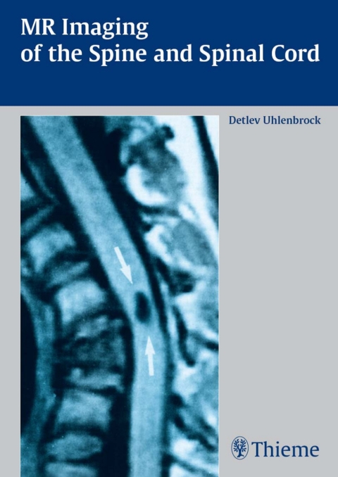 Cover image for book MR Imaging of the Spine and Spinal Cord