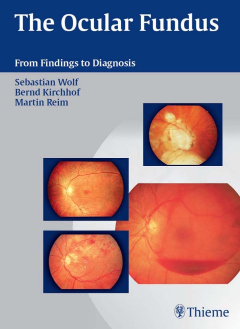 Cover image for book The Ocular Fundus