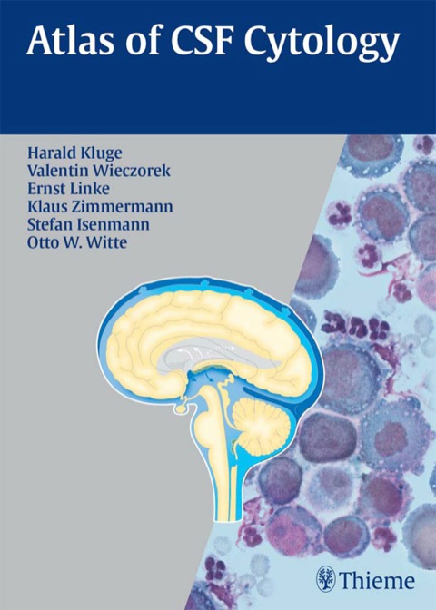 Cover image for book Atlas of CSF Cytology