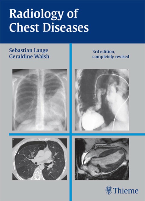 Cover image for book Radiology of Chest Diseases