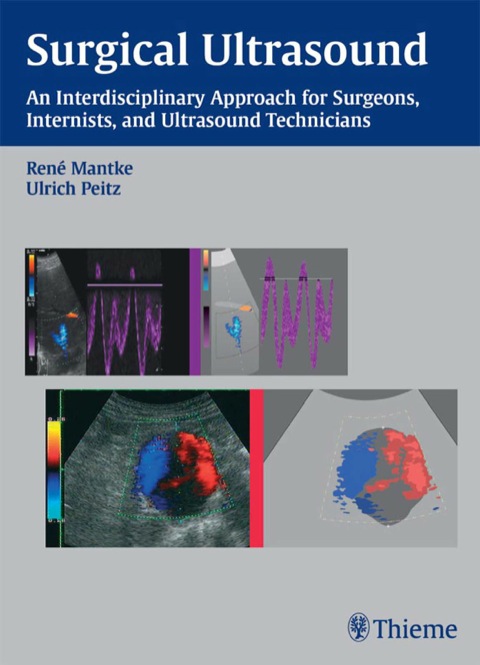 Cover image for book Surgical Ultrasound