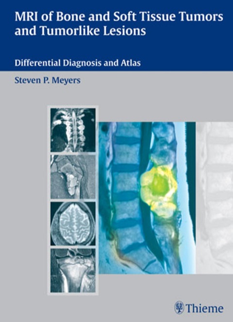MRI of Bone and Soft Tissue Tumors and Tumorlike Lesions 