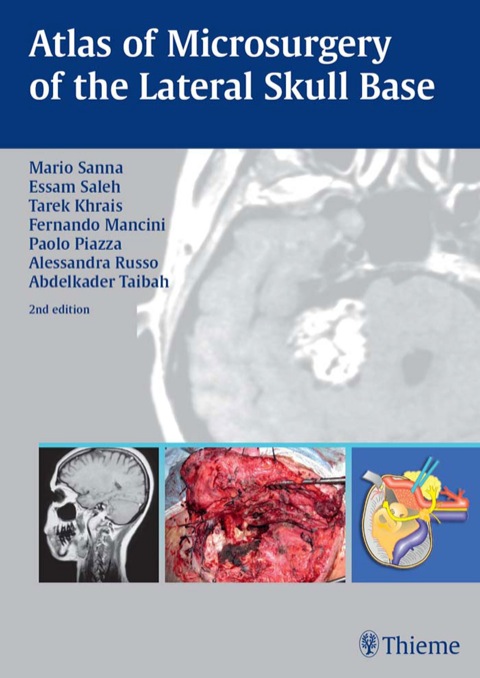 Atlas of Microsurgery of the Lateral Skull Base 