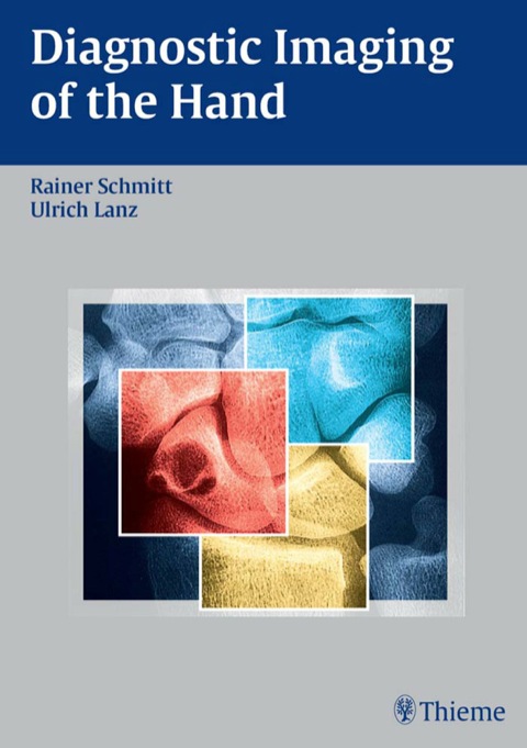 Cover image for book Diagnostic Imaging of the Hand