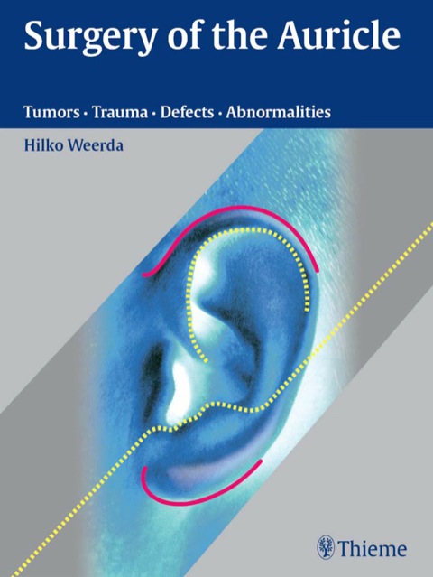 Cover image for book Surgery of the Auricle