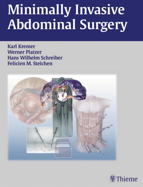 Cover image for book Minimally Invasive Abdominal Surgery
