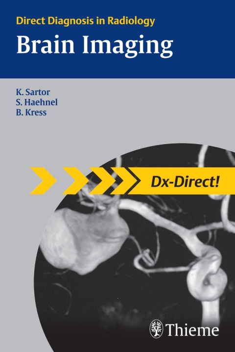 Cover image for book Brain Imaging