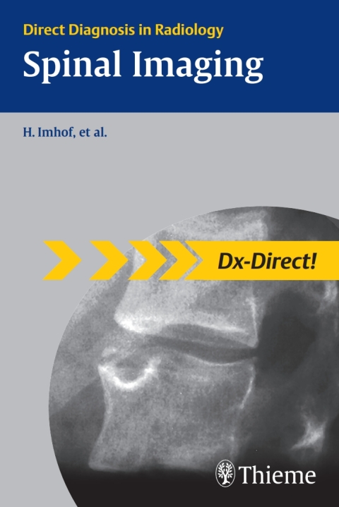 Cover image for book Spinal Imaging