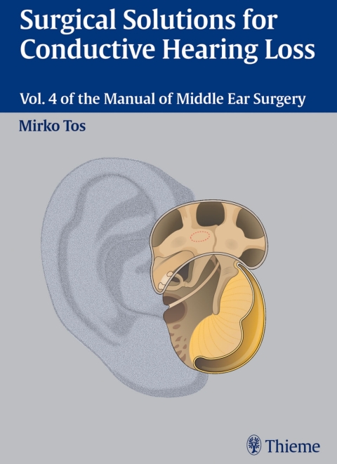 Cover image for book Surgical Solutions for Conductive Hearing Loss