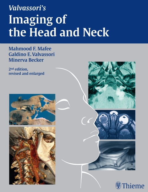 Cover image for book Imaging of the Head and Neck