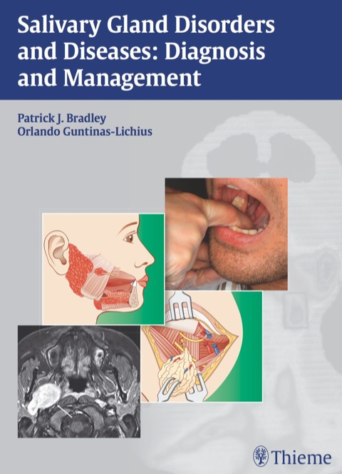 Cover image for book Salivary Gland Disorders and Diseases