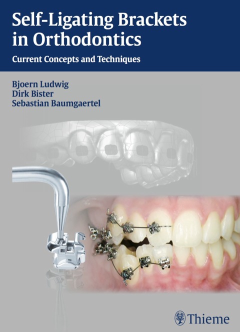 Cover image for book Self-Ligating Brackets in Orthodontics