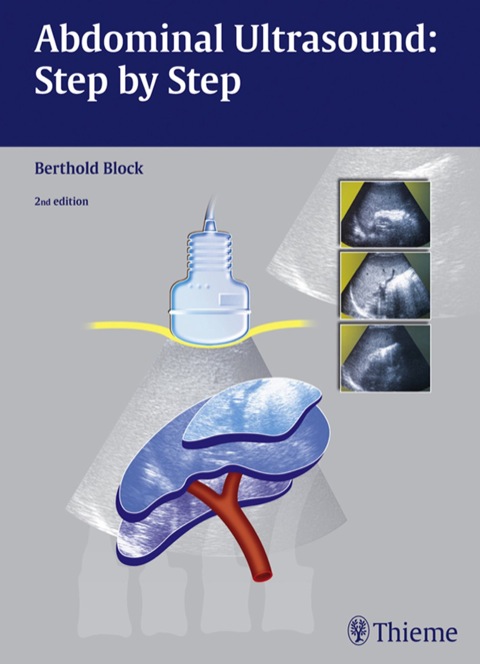 Abdominal Ultrasound: Step by Step 