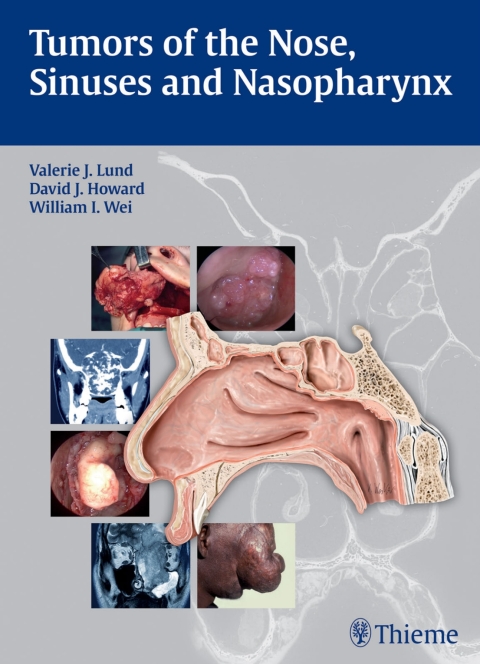 Cover image for book Tumors of the Nose, Sinuses and Nasopharynx