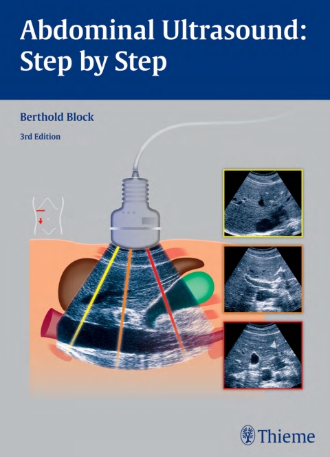 Cover image for book Abdominal Ultrasound: Step by Step