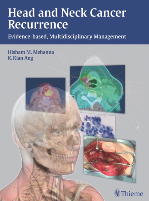 Cover image for book Head and Neck Cancer Recurrence