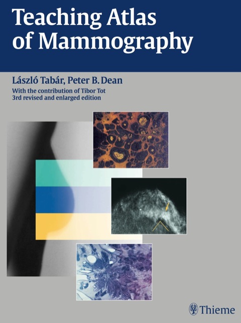Cover image for book Teaching Atlas of Mammography