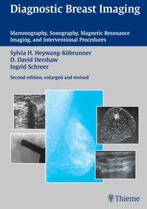 Cover image for book Diagnostic Breast Imaging