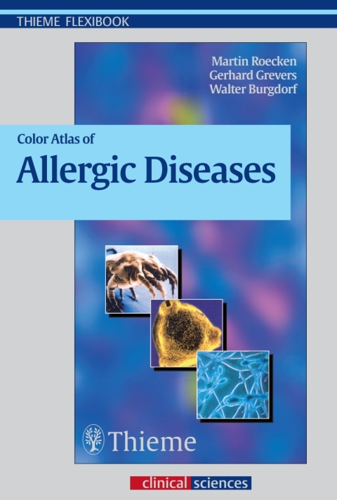 Cover image for book Color Atlas of Allergic Diseases