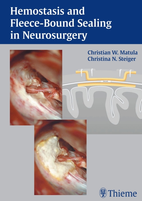 Cover image for book Hemostasis and Fleece-Bound Sealing in Neurosurgery