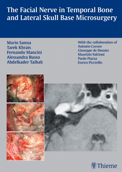 The Facial Nerve in Temporal Bone and Lateral Skull Base Microsurgery 