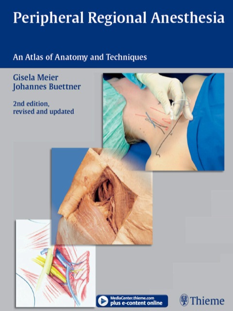 Cover image for book Peripheral Regional Anesthesia