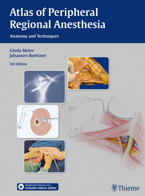 Cover image for book Atlas of Peripheral Regional Anesthesia