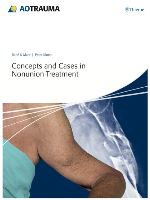 Concepts and Cases in Nonunion Treatment 