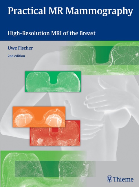 Practical MR Mammography 