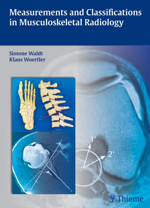 Cover image for book Measurements and Classifications in Musculoskeletal Radiology