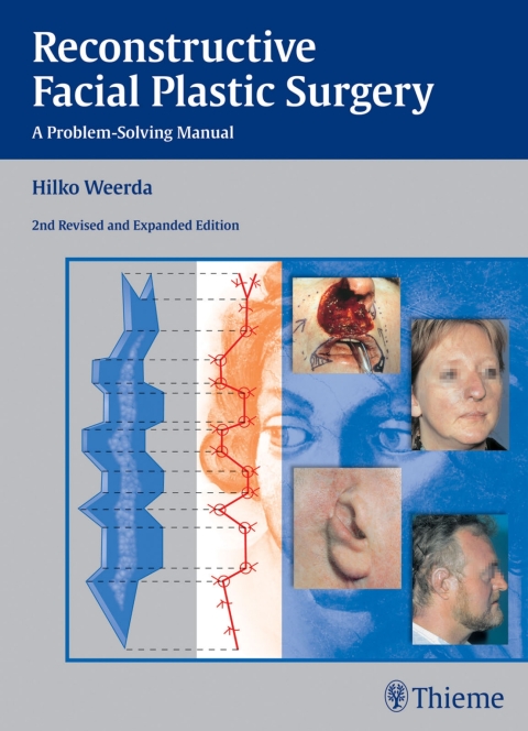 Cover image for book Reconstructive Facial Plastic Surgery