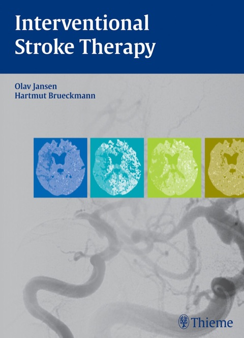 Cover image for book Interventional Stroke Therapy