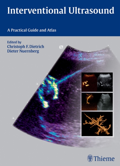 Cover image for book Interventional Ultrasound