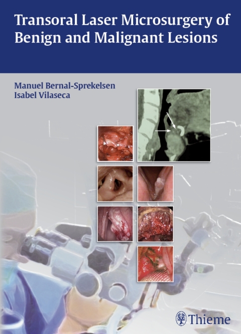 Cover image for book Transoral Laser Microsurgery of Benign and Malignant Lesions