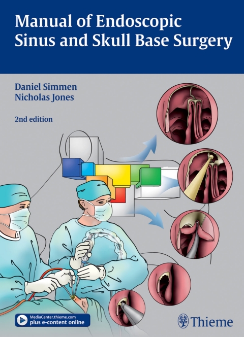 Cover image for book Manual of Endoscopic Sinus and Skull Base Surgery