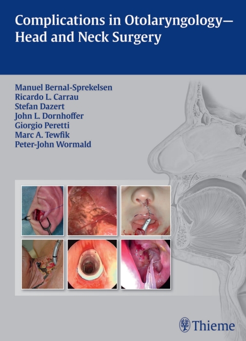 Cover image for book Complications in Otolaryngology - Head and Neck Surgery