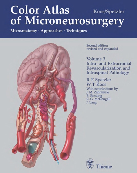 Color Atlas of Microneurosurgery, Vol. 3 Microanatomy, Approaches and T