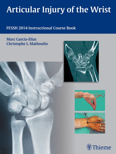 Cover image for book Articular Injury of the Wrist