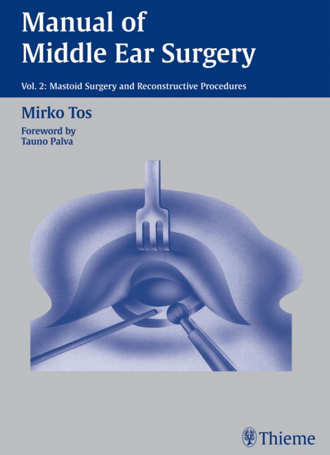 Cover image for book Manual of Middle Ear Surgery