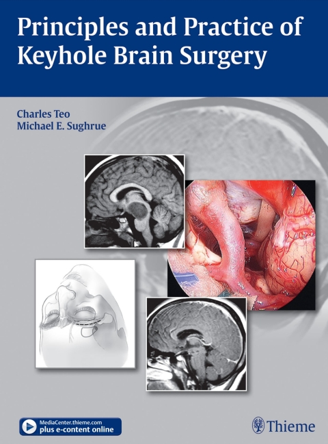 Cover image for book Principles and Practice of Keyhole Brain Surgery
