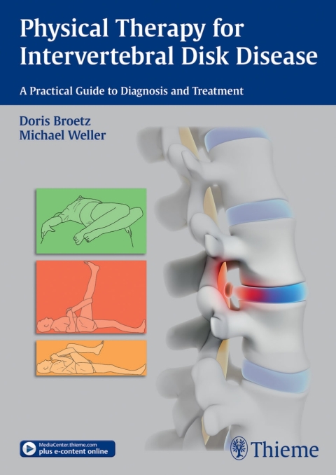 Physical Therapy for Intervertebral Disk Disease 