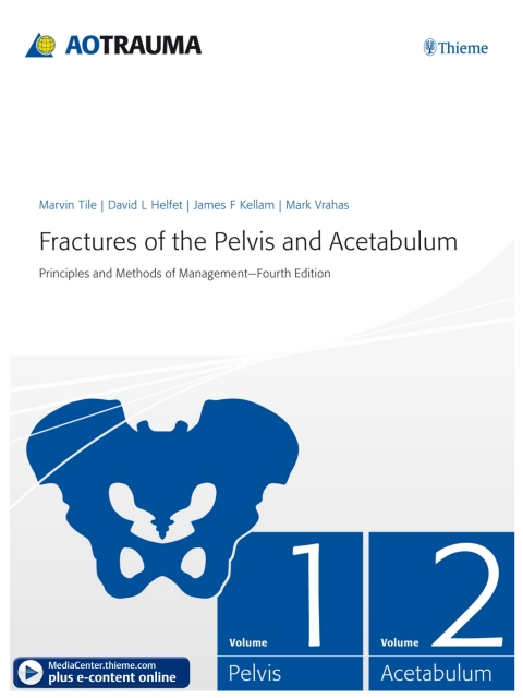 Fractures of the Pelvis and Acetabulum 