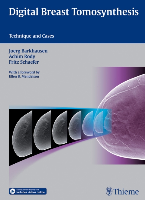 Cover image for book Digital Breast Tomosynthesis