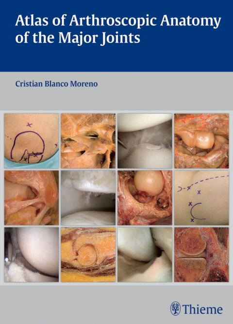 Cover image for book Atlas of Arthroscopic Anatomy of the Major Joints